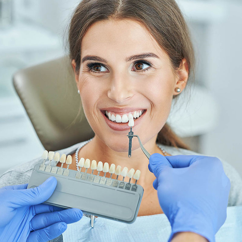 Dantų balinimas kapomis